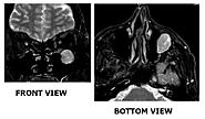 Click image for larger version. 

Name:	MRI.....jpg 
Views:	89 
Size:	78.1 KB 
ID:	460428