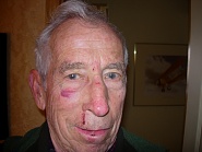 Click image for larger version. 

Name:	Gene face.jpg 
Views:	34 
Size:	399.8 KB 
ID:	501922